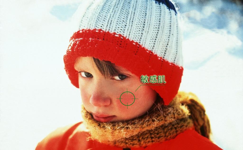 敏感肌修护市场的缘起和未来 | 敏感肌终结者